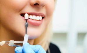 A dentist using a shade guide to assess their patient’s smile