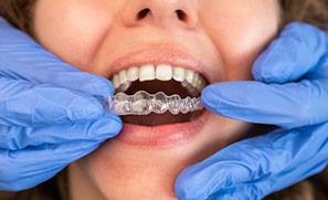 Your dental insurance may cover some of your Invisalign treatment