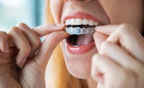 Patient in Kent putting in their Invisalign aligners