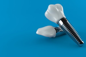Two dental implants lying against each other
