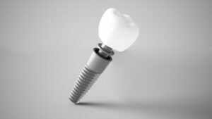 Model of a dental implant against a gray background