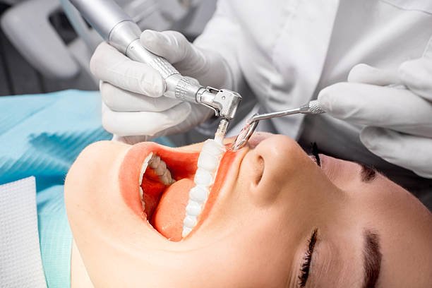 dental cleaning